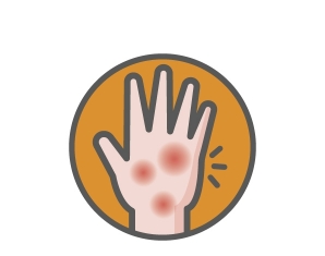 J7452 Zyrtec-Home Page 敏感資訊Icon 596x470_op_Sensitive Skin